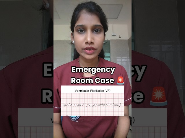 Ventricular Fibrillation l Norcet l  #nursingexam #norcet #nursingofficer #aiimsnursingofficer