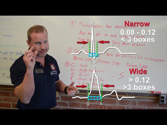 SVT vs Sinus Tachycardia Part 2