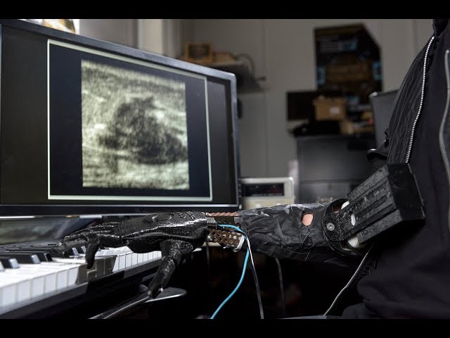 Gil Weinberg: Luke Skywalker Prosthesis Controls Fingers and Plays Piano