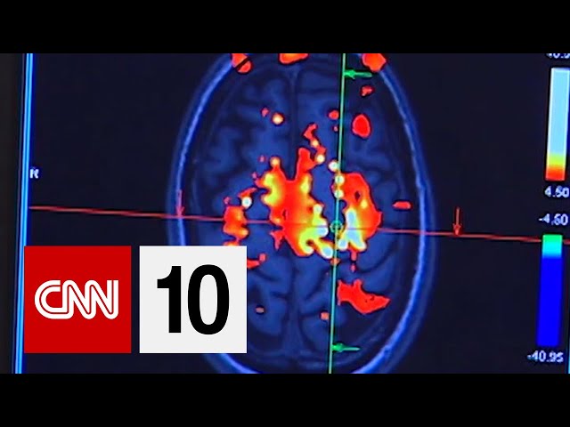 What Is CTE?