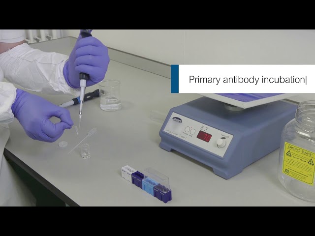 IHC for brain slice sections   video protocol