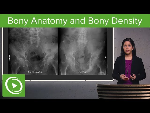 Imaging of Bones: Fractures, Bony Anatomy and Bony Density – Radiology | Lecturio