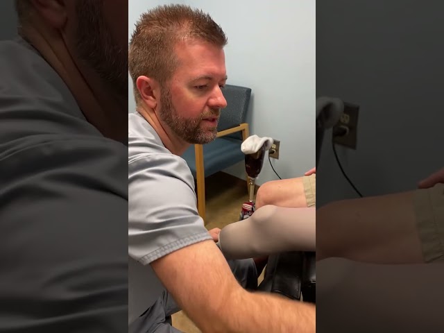 Transtibial Direct Socket Fabrication Part 1 🦿(Prosthetic Leg)