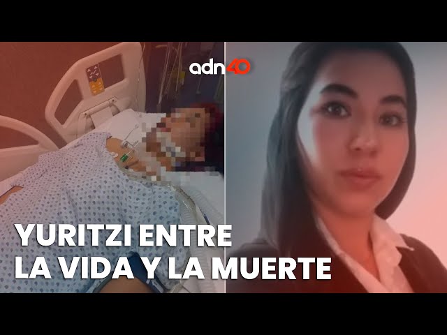Yuritzi está internada en un hospital por practicarse una liposucción | México en Tiempo Real