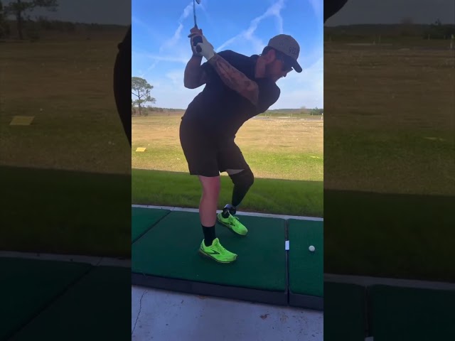 Below-Knee Prosthetic Leg in Action | Daniel