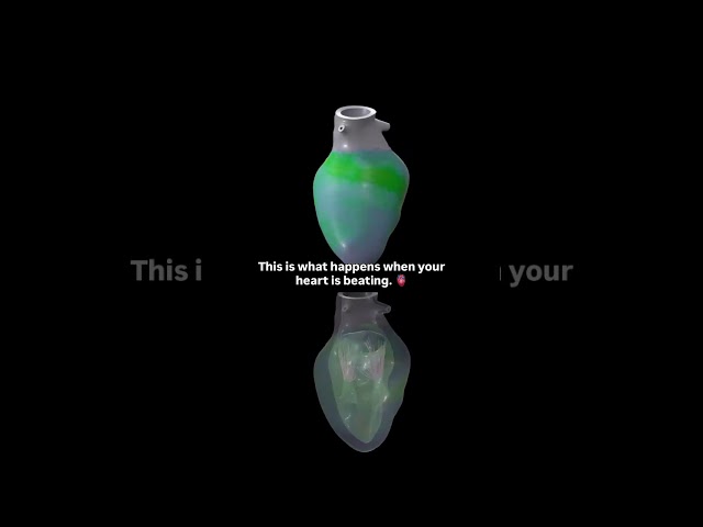 Your heart, powered by SOLIDWORKS Simulation