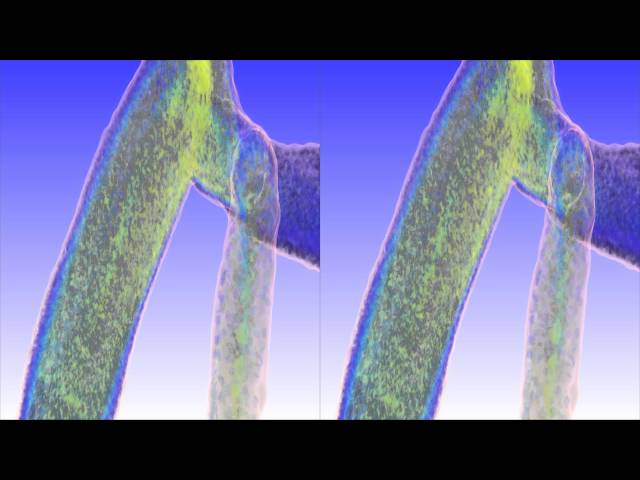 Stereo3D ScienceVisuals/Visualbiotech "Computational Multiscale Hemodynamics"