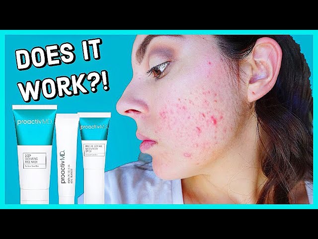 Does Proactiv MD Really Work?! Honest 2 Month Review