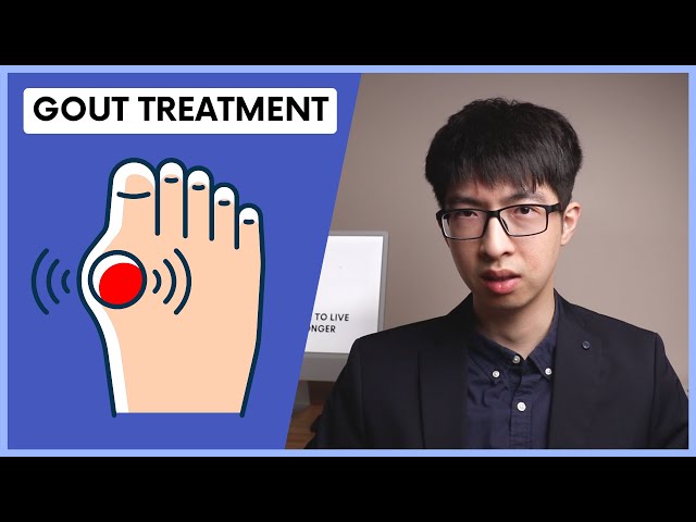 Gout Treatment: How to Relieve Gout Attack