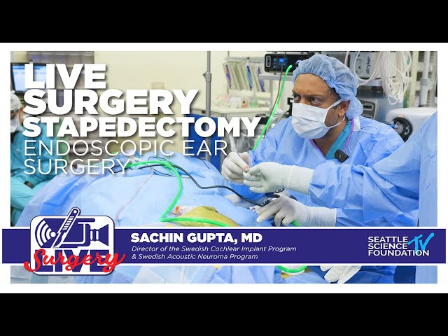 Live Endoscopic Ear Surgery - Stapedectomy - Sachin Gupta, M.D.