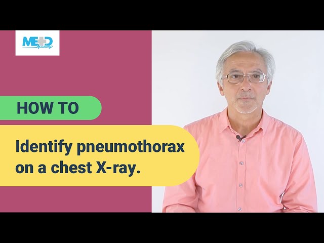 How to identify pneumothorax on a chest X-ray