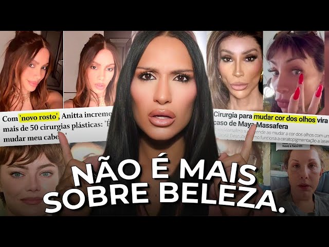 FACELIFT AOS 30, OLHOS DE BONECA, HARMONIZAÇÃO E O COLAPSO DA IDENTIDADE NAS INFLUENCERS E FAMOSAS.