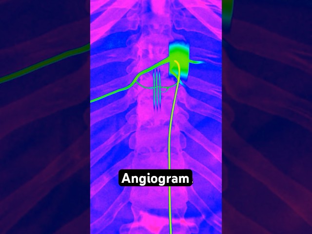 Mapping Your Blood Vessels
