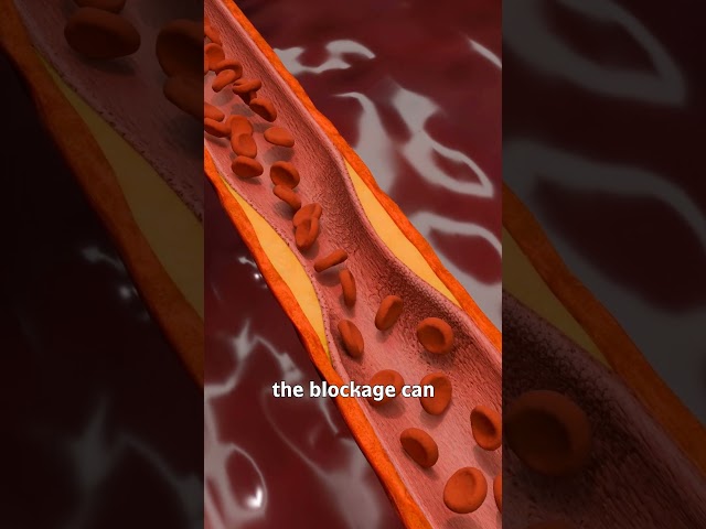How A Heart Attack Happens 😱