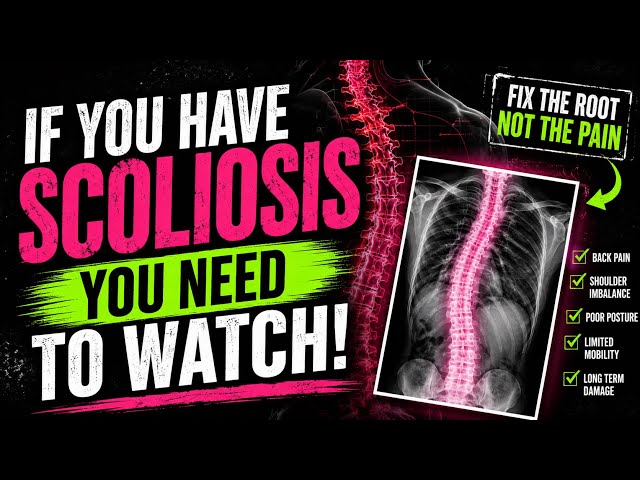 Laura’s incredible SCOLIOSIS Breakthrough!
