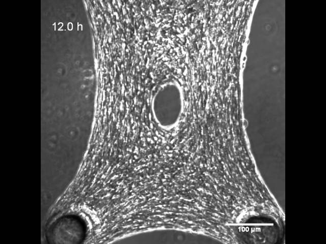Research: 3D Microtissue Wound Healing courtesy of Prof. Christopher Chen (BME)