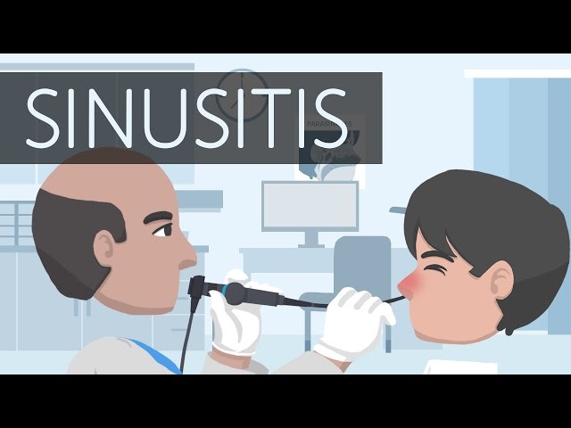 What is Sinusitis?