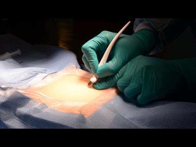 Confirm Rx Implant Tutorial