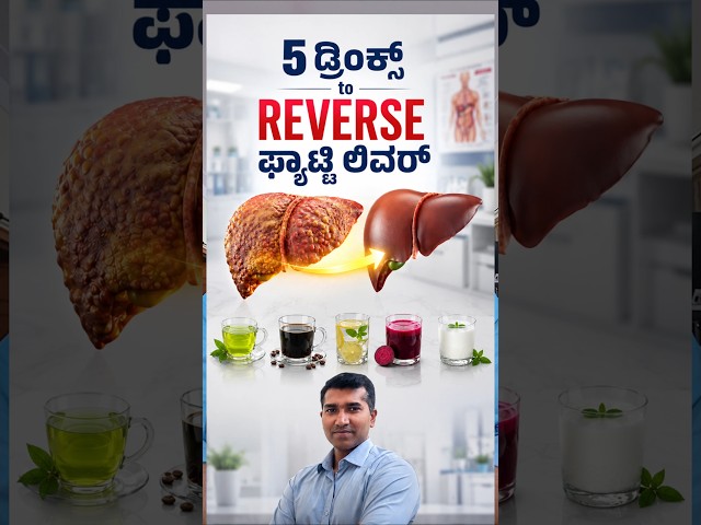 Fatty Liver? ಈ 5 Drinks ಬಗ್ಗೆ ತಿಳಿಯಿರಿ!