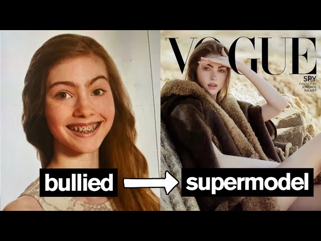 BULLIED TEENAGER BECOMES SUPERMODEL *Emotional*