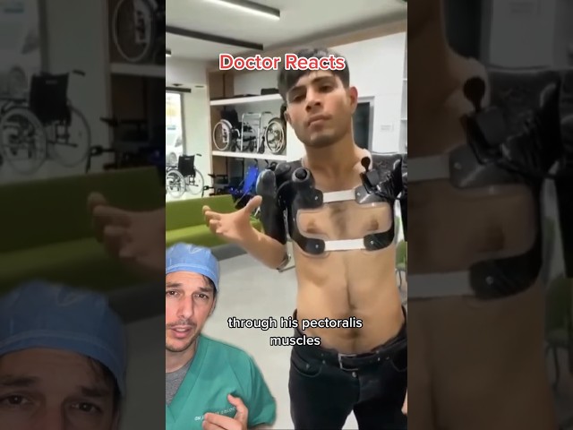 The power of modern engineering #Prosthesis #Myoelectric #Muscle #Bionic #Arm #Therapy #Amazing