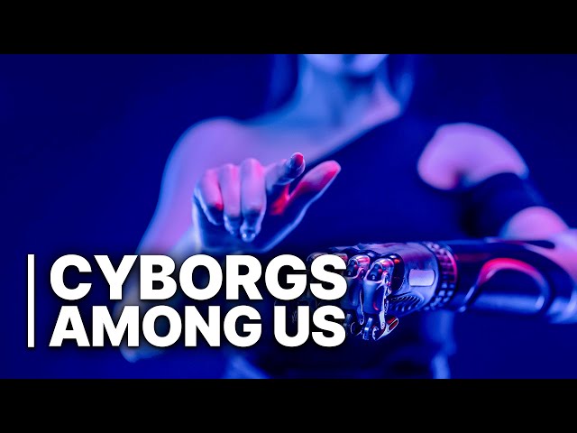 Cyborgs Among Us | Are THEY the Next Human Evolution | Medical Marvels or Sci-Fi Nightmares