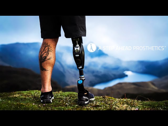 Understanding the Benefits of CUSTOM-MADE PROSTHETICS and Orthotics