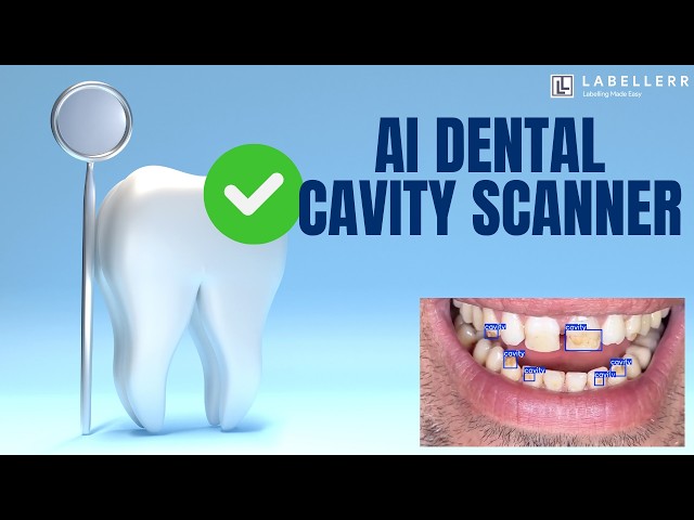 Can AI Replace Your Dentist?! Testing YOLO11 Vision 🤖💡