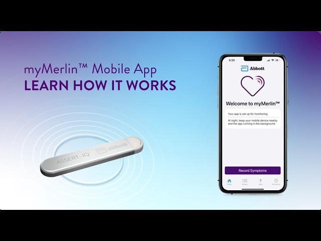myMerlin™ Mobile App for Assert-IQ™ ICM: How it Works