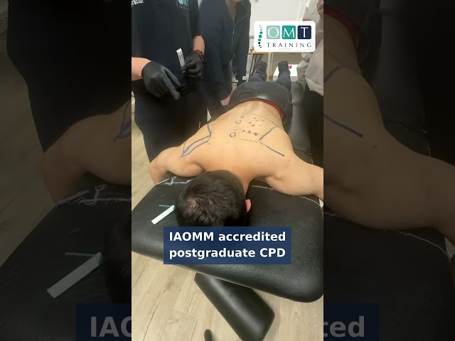 Learn dry needling #manualtherapy #physiotherapist