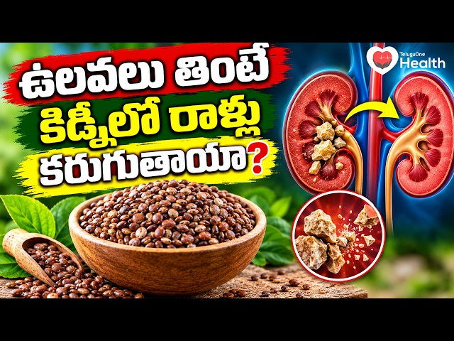 Horse Gram Benefits | ఉలవలు తింటే కిడ్నీలో రాళ్లు కరుగుతాయా?| Dr. Ch Madhusudhana Sharma| ToneHealth