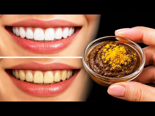 Dentists are hiding secrets from us! 🔥 Whitens teeth and removes tartar in 2 minutes.