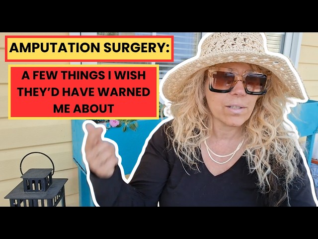 Leg Amputation, Post Op: Here's What to Expect