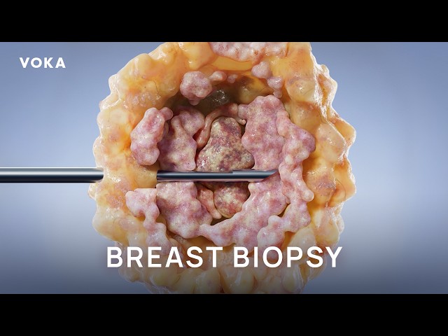 Breast Biopsy: 3D Medical Procedure Visualization