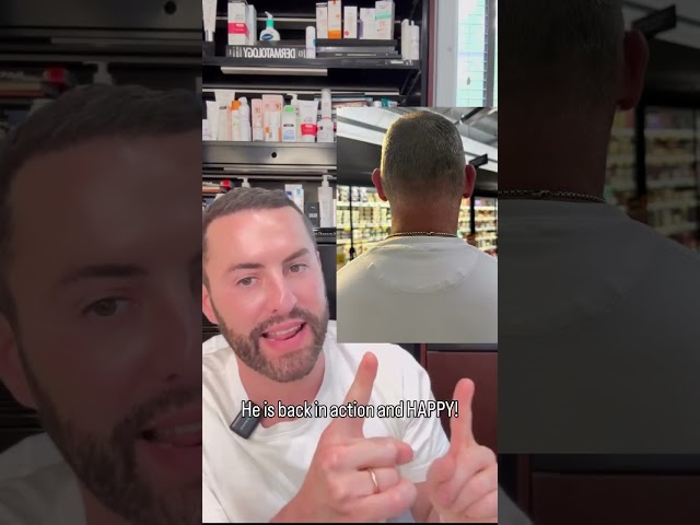 Alopecia Areata Treatment Journey with Dr. Glodny at Park Avenue Dermatology