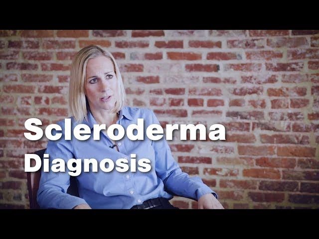 Diagnosing Scleroderma | Johns Hopkins