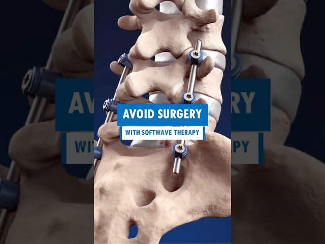 Options to Avoid Surgery #shorts