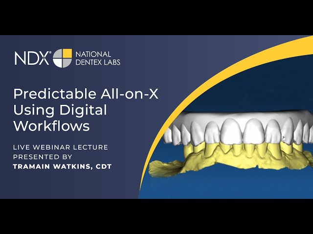 Predictable All‑on‑X Using Digital Workflows