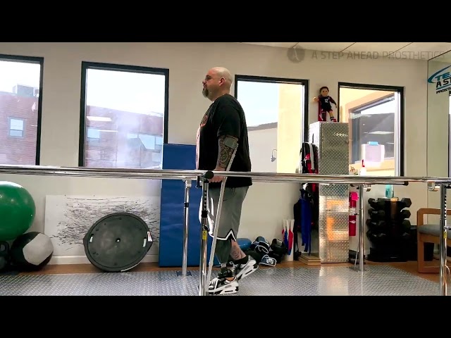 Nick a below knee amputee progress video since becoming an amputee