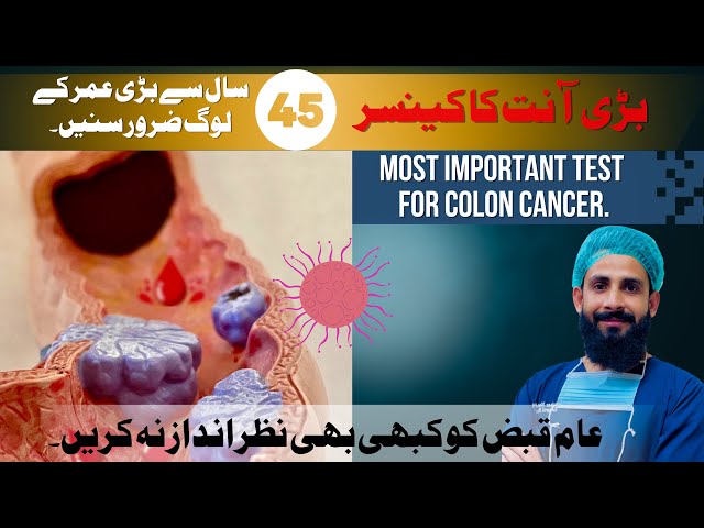 Colon Cancer Symptoms | WorkUp and Treatment