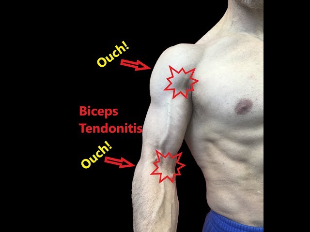 Biceps Tendonitis Treatment At Home (Relieve Pain Fast)