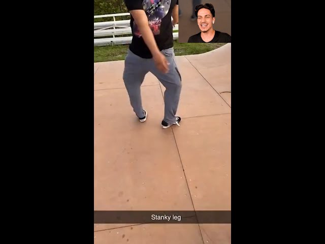 Man Walks with Backwards Feet! *Stanky Leg* #shorts