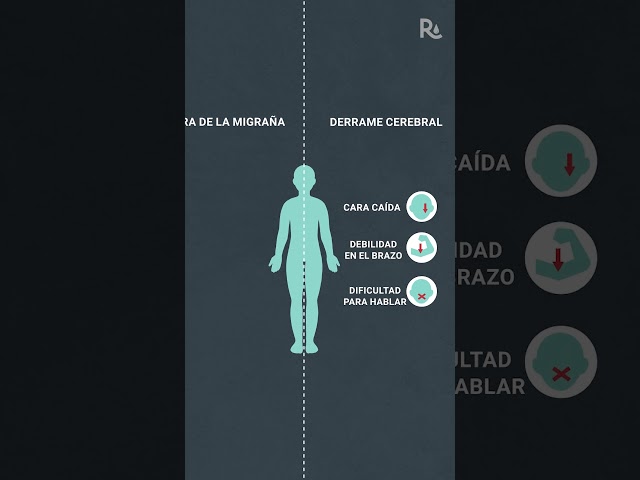 ¿Aura de migraña o derrame cerebral? Cómo reconocer la diferencia