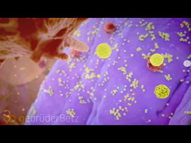 Prevention of Postoperative Wound Infections | Medical Animation