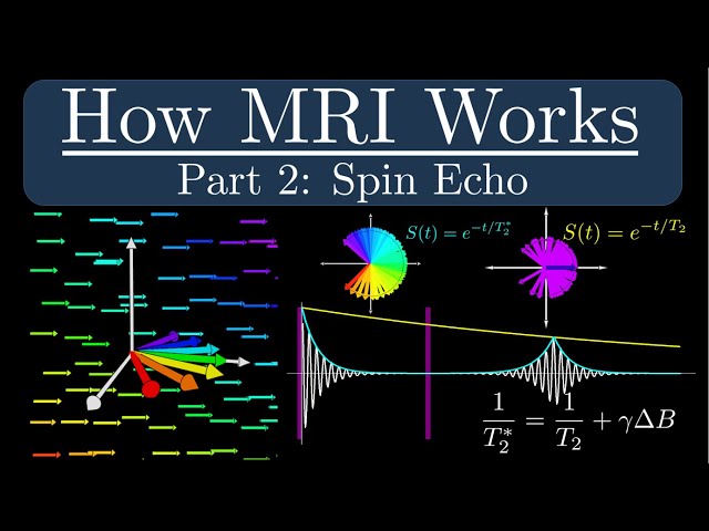 How MRI Works - Part 2 - The Spin Echo