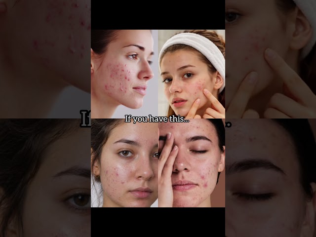 product for your skin problem ✨ #aestheic #skincare #love #aestheic #glowup #reels #beauty #yt