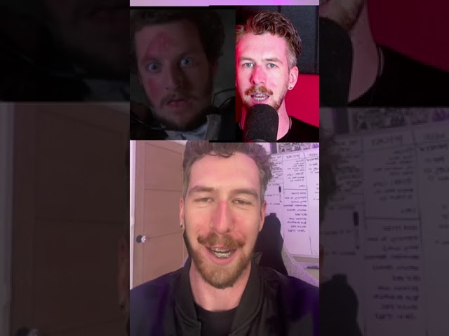 This burn is worse than Marv’s |  Lewis Spears