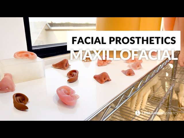 Custom Maxillofacial Prosthetics: Solutions for Facial Restoration and Function