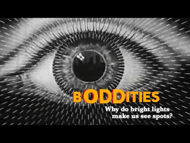 Boddities | Episode 5 | Why do bright lights make us see spots?
