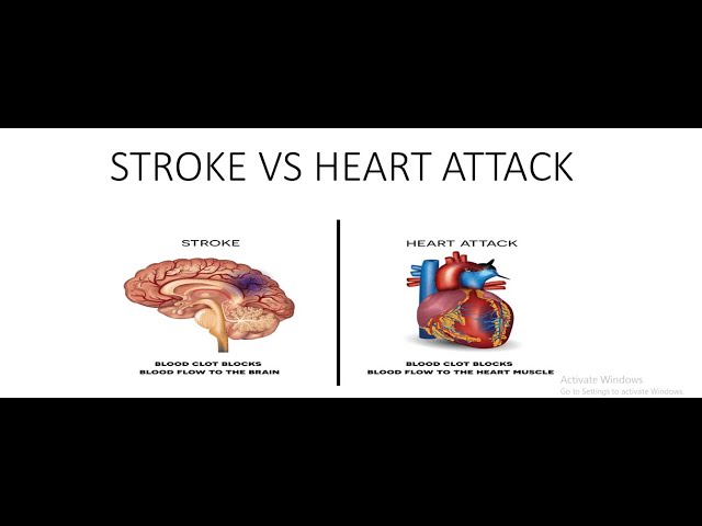 what is the difference between heart attack and stock & how to prevent from this in tamil